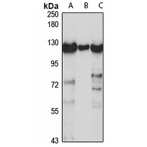 LDL Receptor Rabbit Polyclonal Antibody