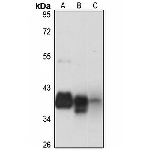 TGF beta 4 Rabbit Polyclonal Antibody