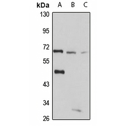 LGI1 Rabbit Polyclonal Antibody