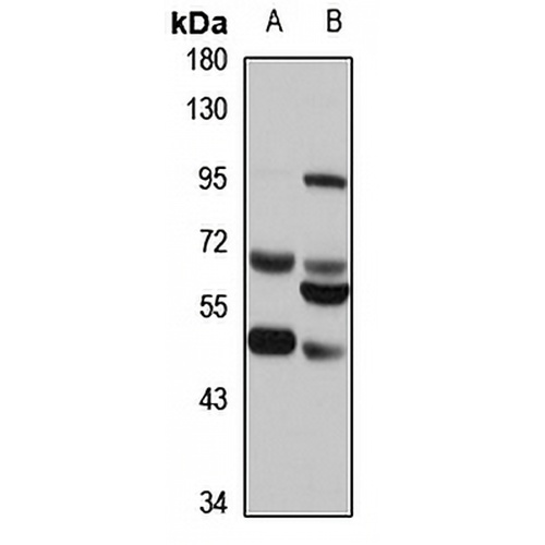 Legumain Rabbit Polyclonal Antibody