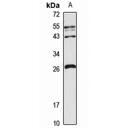 LHFPL2 Rabbit Polyclonal Antibody