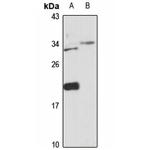 LIME Rabbit Polyclonal Antibody