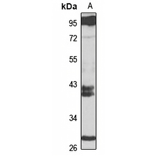 LIN28A Rabbit Polyclonal Antibody