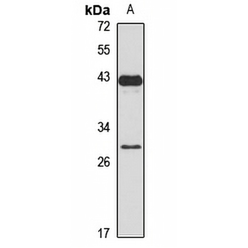 LIN28B Rabbit Polyclonal Antibody