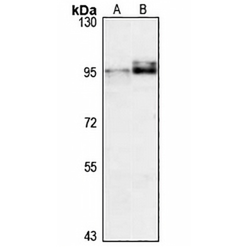 LOXL2 Rabbit Polyclonal Antibody