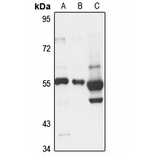 LPAAT eta Rabbit Polyclonal Antibody