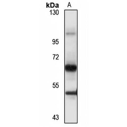 LPL Rabbit Polyclonal Antibody