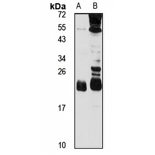 LSM12 Rabbit Polyclonal Antibody