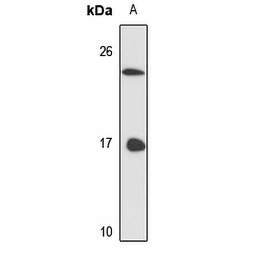 LSm3 Rabbit Polyclonal Antibody