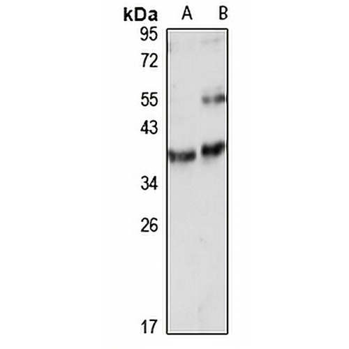 LYPD3 Rabbit Polyclonal Antibody