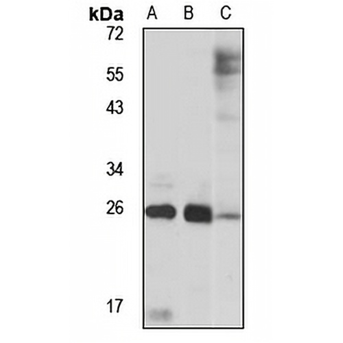 LYPLA2 Rabbit Polyclonal Antibody