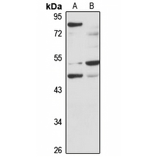 MAGEA11 Rabbit Polyclonal Antibody
