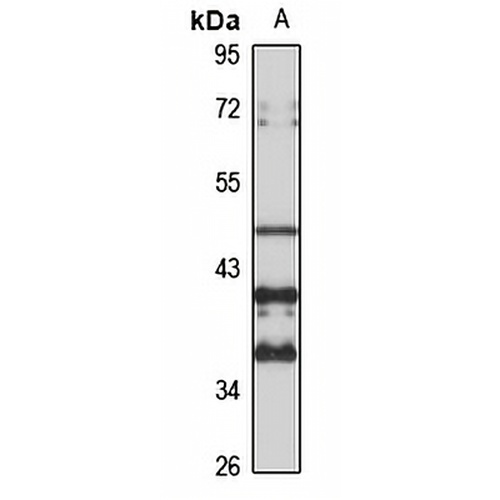 MagT1 Rabbit Polyclonal Antibody
