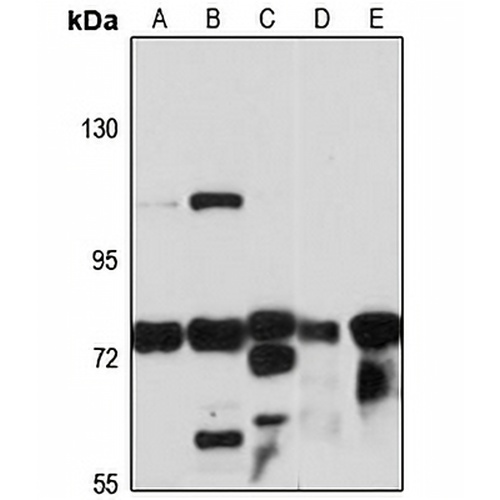 MAN1B1 Rabbit Polyclonal Antibody