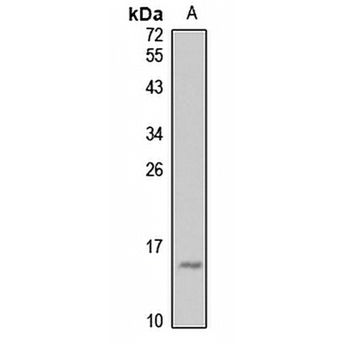 ARMET Rabbit Polyclonal Antibody