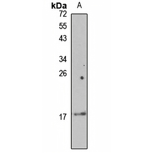 ARMET Rabbit Polyclonal Antibody