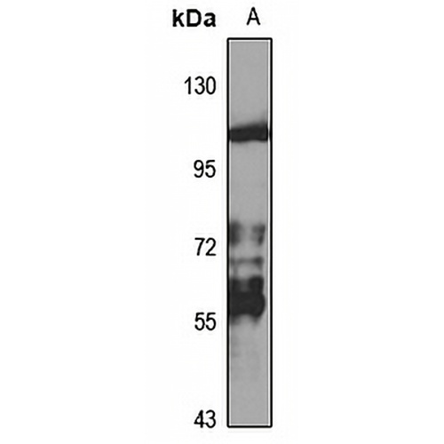 DLK Rabbit Polyclonal Antibody