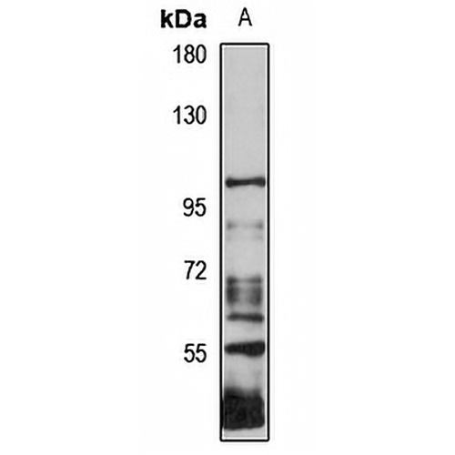 NIK Rabbit Polyclonal Antibody