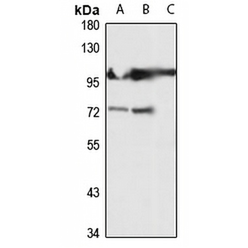 GCK Rabbit Polyclonal Antibody