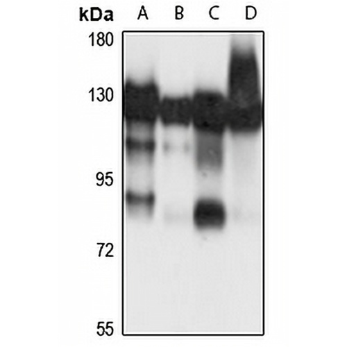 Matrin 3 Rabbit Polyclonal Antibody