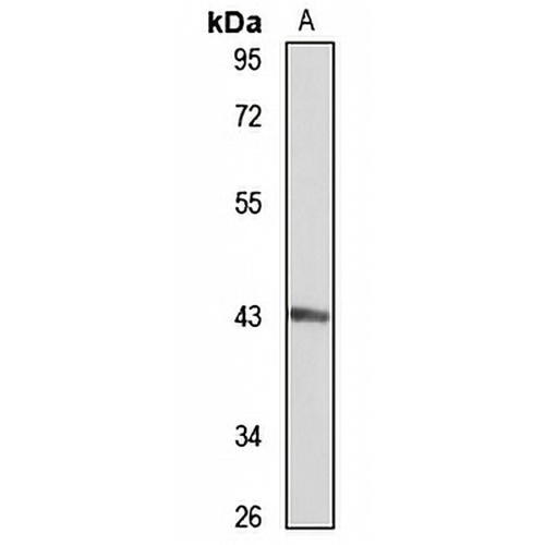MCAT Rabbit Polyclonal Antibody
