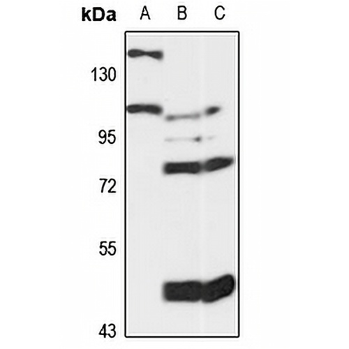 MCC Rabbit Polyclonal Antibody