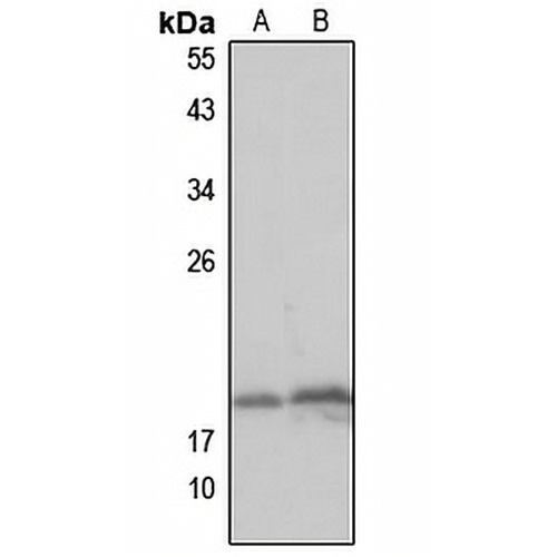MCEE Rabbit Polyclonal Antibody