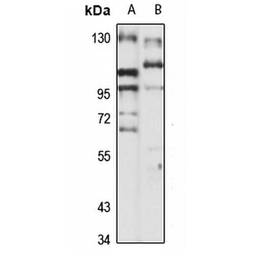DBS Rabbit Polyclonal Antibody