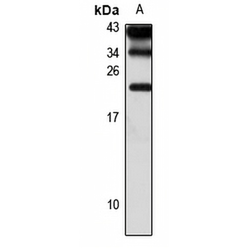 MCTS1 Rabbit Polyclonal Antibody