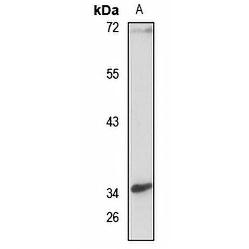 CCDC109A Rabbit Polyclonal Antibody