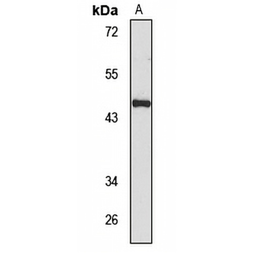 MDM4 Rabbit Polyclonal Antibody