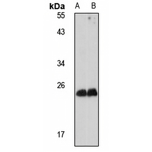 MED20 Rabbit Polyclonal Antibody
