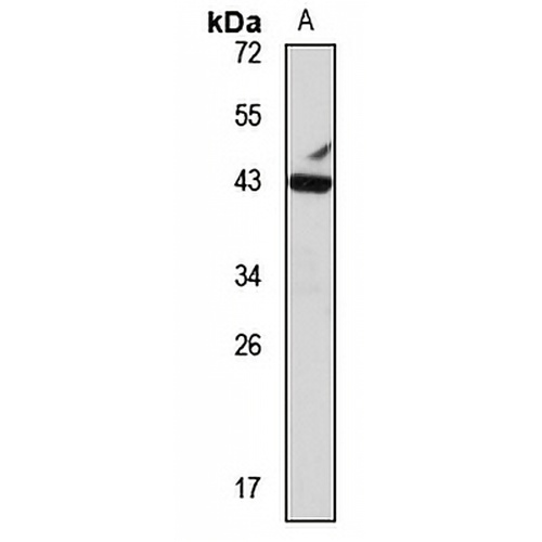 MEF2B Rabbit Polyclonal Antibody