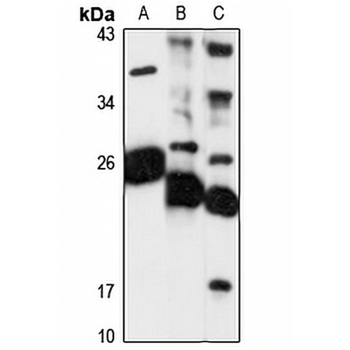 MESDC2 Rabbit Polyclonal Antibody