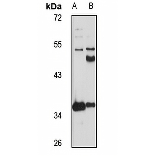 METTL1 Rabbit Polyclonal Antibody