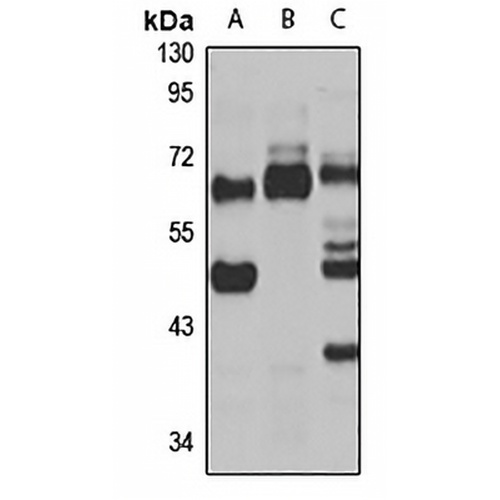 METTL14 Rabbit Polyclonal Antibody