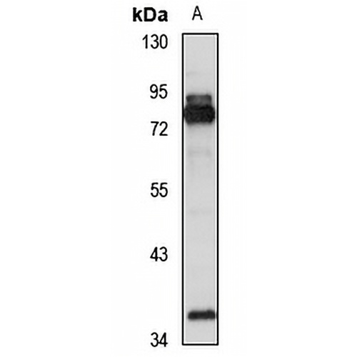 METTL16 Rabbit Polyclonal Antibody