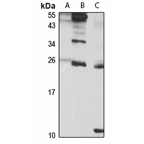 METTL5 Rabbit Polyclonal Antibody