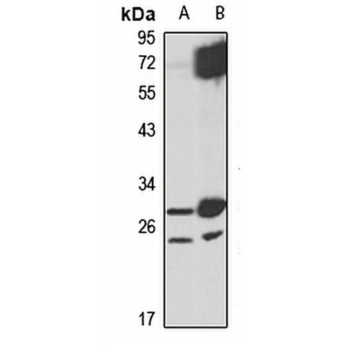METTL7B Rabbit Polyclonal Antibody