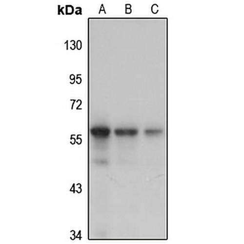 GnT-IVa Rabbit Polyclonal Antibody
