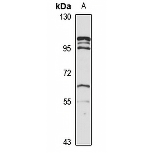 GnT-IVb Rabbit Polyclonal Antibody