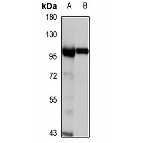 MGAT5 Rabbit Polyclonal Antibody
