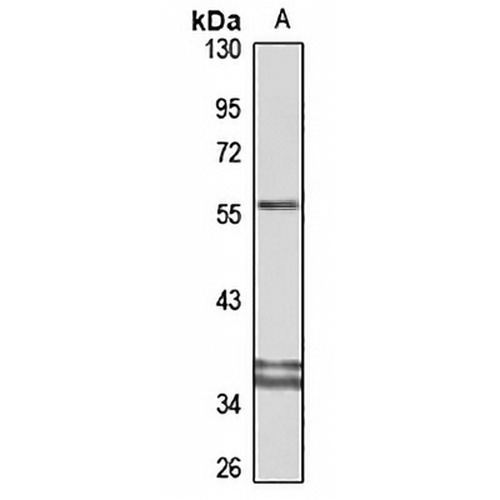 MICB Rabbit Polyclonal Antibody