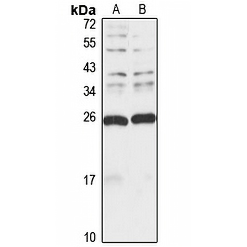 MIS12 Rabbit Polyclonal Antibody