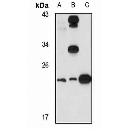 MIXL Rabbit Polyclonal Antibody