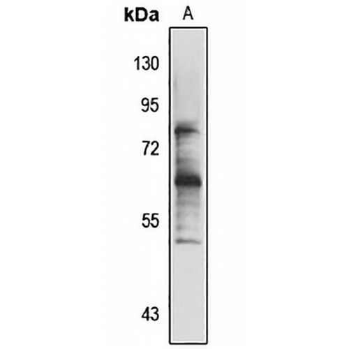 BBS6 Rabbit Polyclonal Antibody