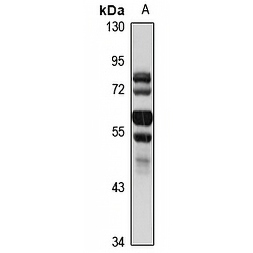 Makorin-3 Rabbit Polyclonal Antibody