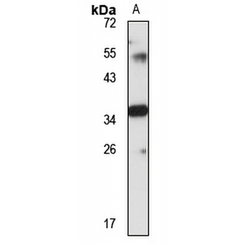 MLKL Rabbit Polyclonal Antibody