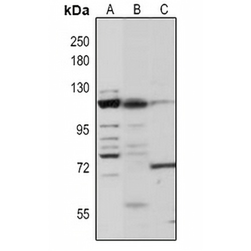 ZCWCC1 Rabbit Polyclonal Antibody