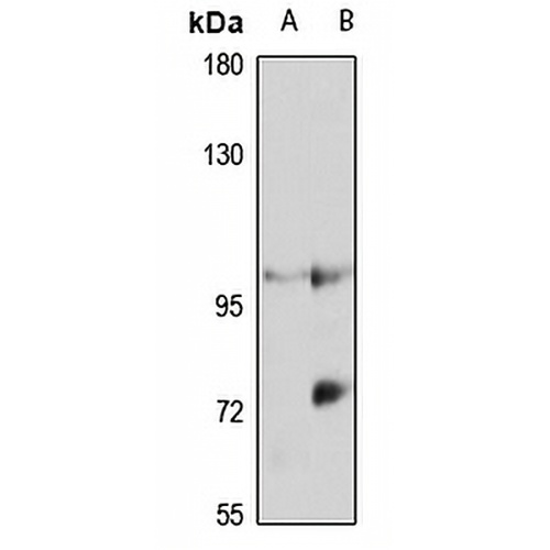 MOV10 Rabbit Polyclonal Antibody